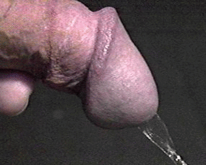 Piss — 20